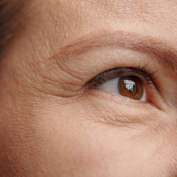 More fine lines & wrinkles