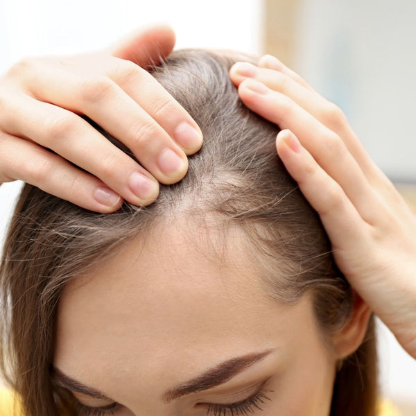 Thinning hair & hair loss