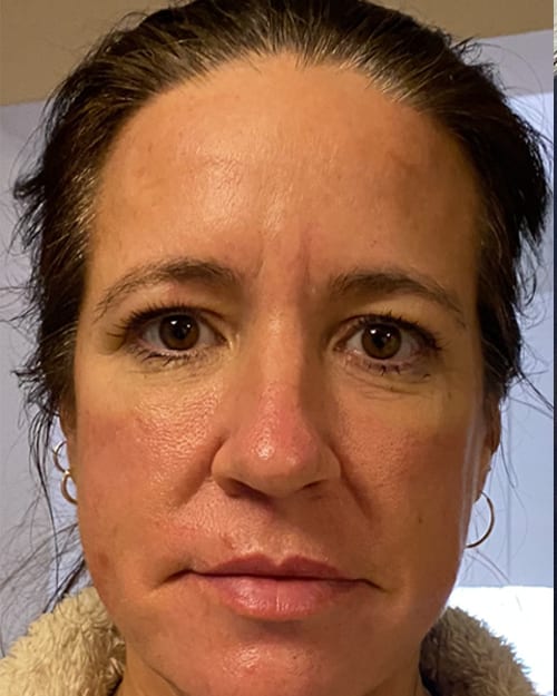 Beth, before